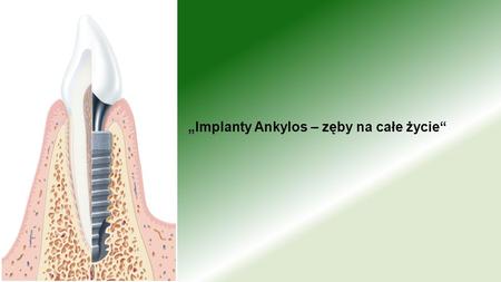 „Implanty Ankylos – zęby na całe życie“