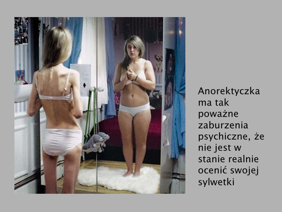Anorektyczka ma tak poważne zaburzenia psychiczne, że nie jest w stanie realnie ocenić swojej sylwetki