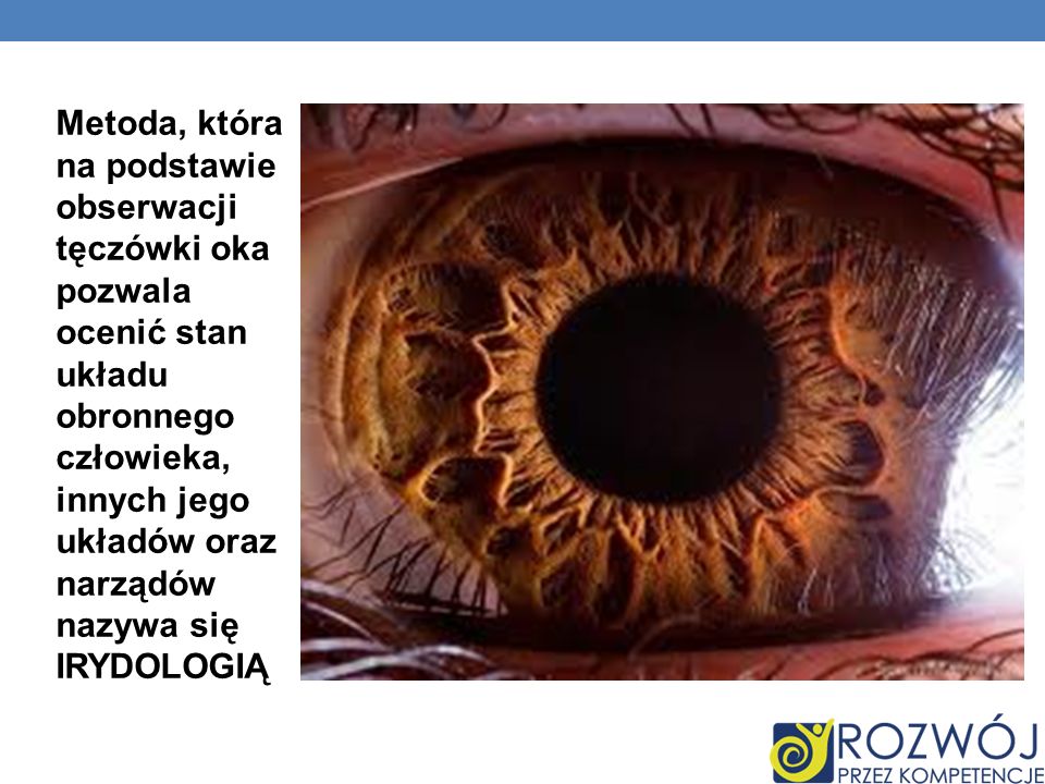 Metoda, która na podstawie obserwacji tęczówki oka pozwala ocenić stan układu obronnego człowieka, innych jego układów oraz narządów nazywa się IRYDOLOGIĄ