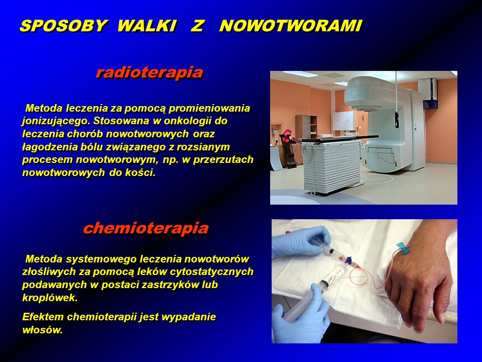 radioterapia chemioterapia