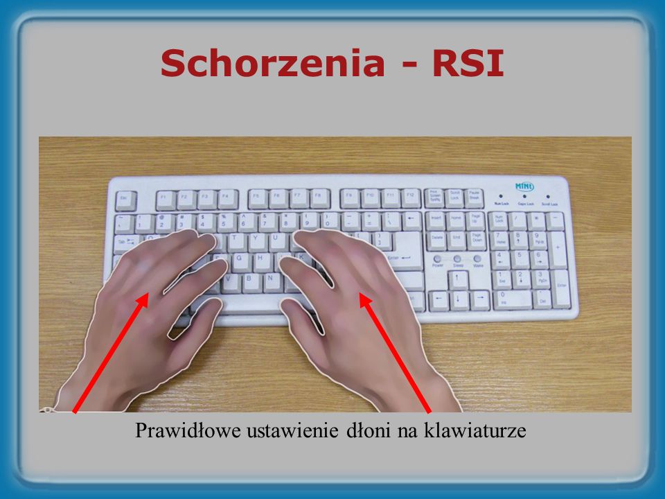 Schorzenia - RSI Prawidłowe ustawienie dłoni na klawiaturze
