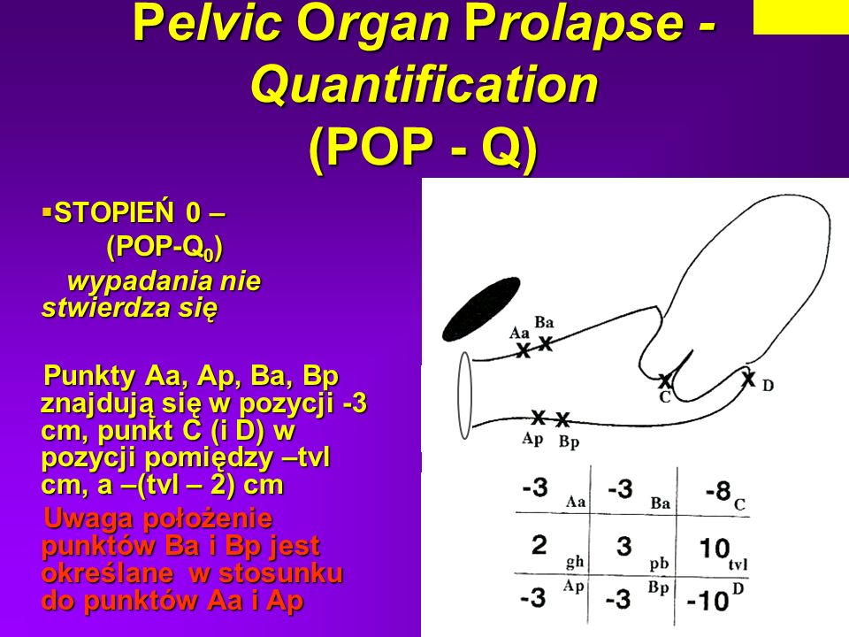 Pelvic Organ Prolapse - Quantification (POP - Q)