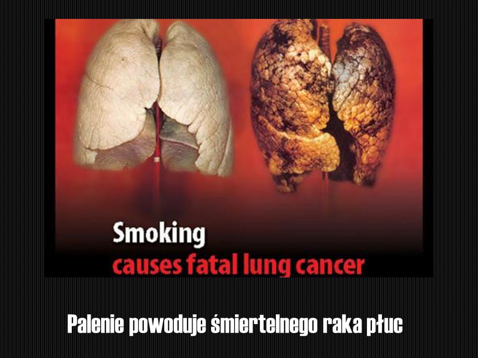 Palenie powoduje śmiertelnego raka płuc