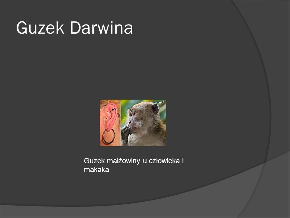 Guzek Darwina Guzek małżowiny u człowieka i makaka