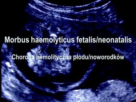 Morbus haemolyticus fetalis/neonatalis Choroba hemolityczna płodu/noworodków.