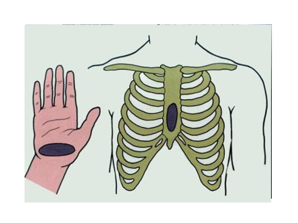 Точки влияния. Точка непрямого массажа сердца. Не примой массаж сердца. Место соприкосновения руки и грудины при непрямом массаже сердца. При непрямом массаже сердца.
