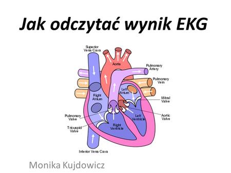 Jak odczytać wynik EKG Monika Kujdowicz.