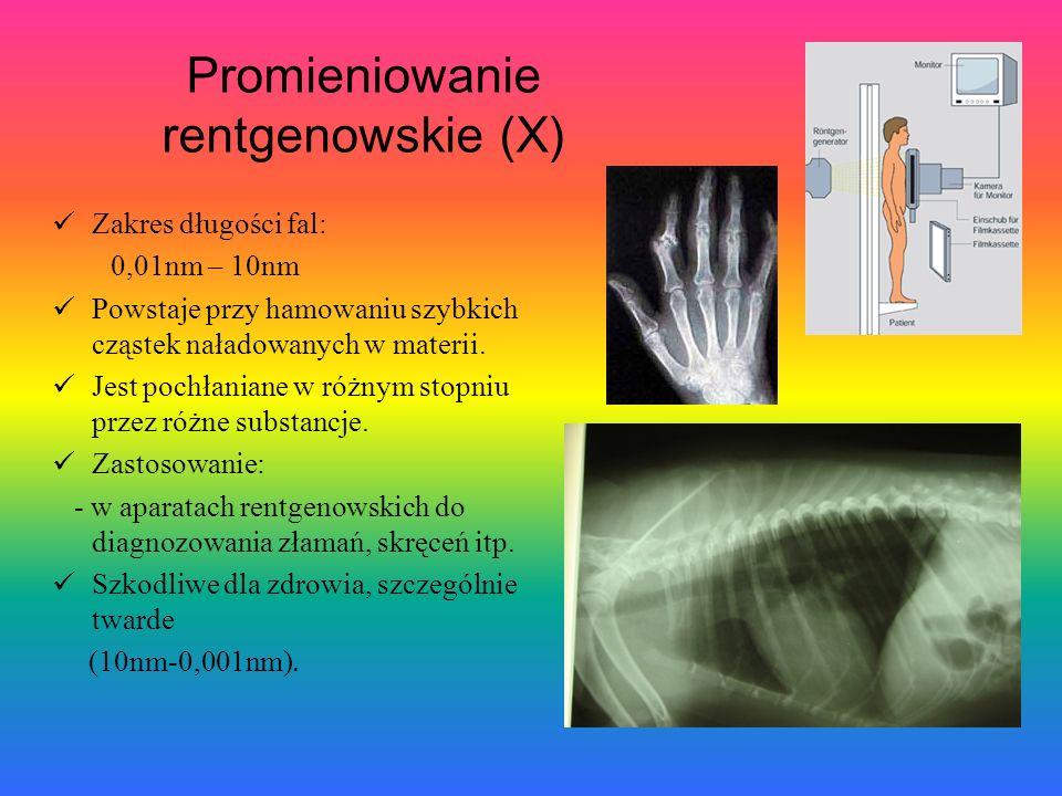 Promieniowanie rentgenowskie (X)