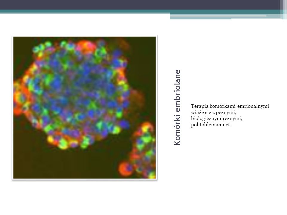 Kliniczne Zastosowania Komórek Macierzystych W Neonatologii Ppt Pobierz 0393