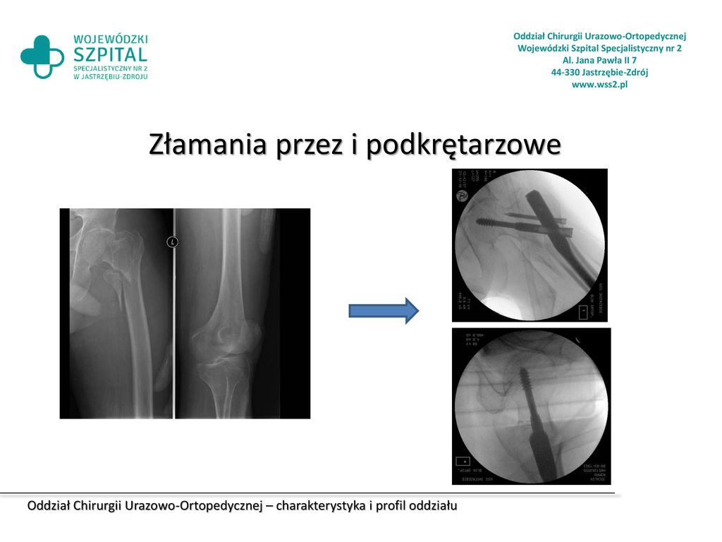 Oddział Chirurgii Urazowo Ortopedycznej Ppt Pobierz 5069