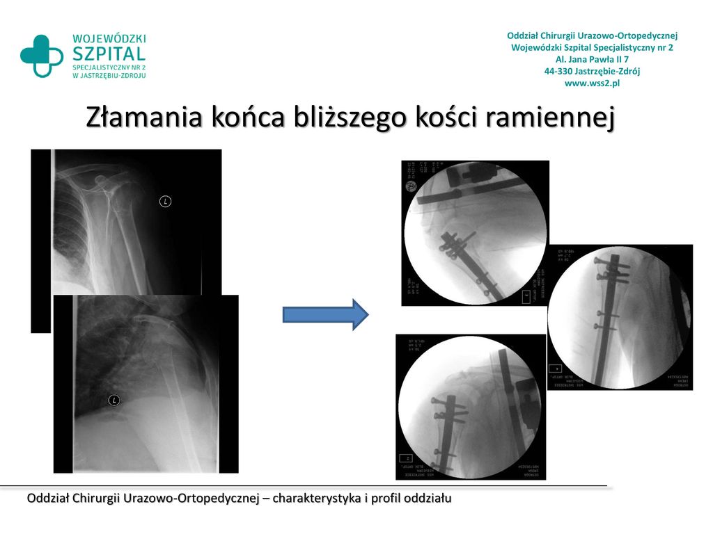 Oddział Chirurgii Urazowo Ortopedycznej Ppt Pobierz 9764