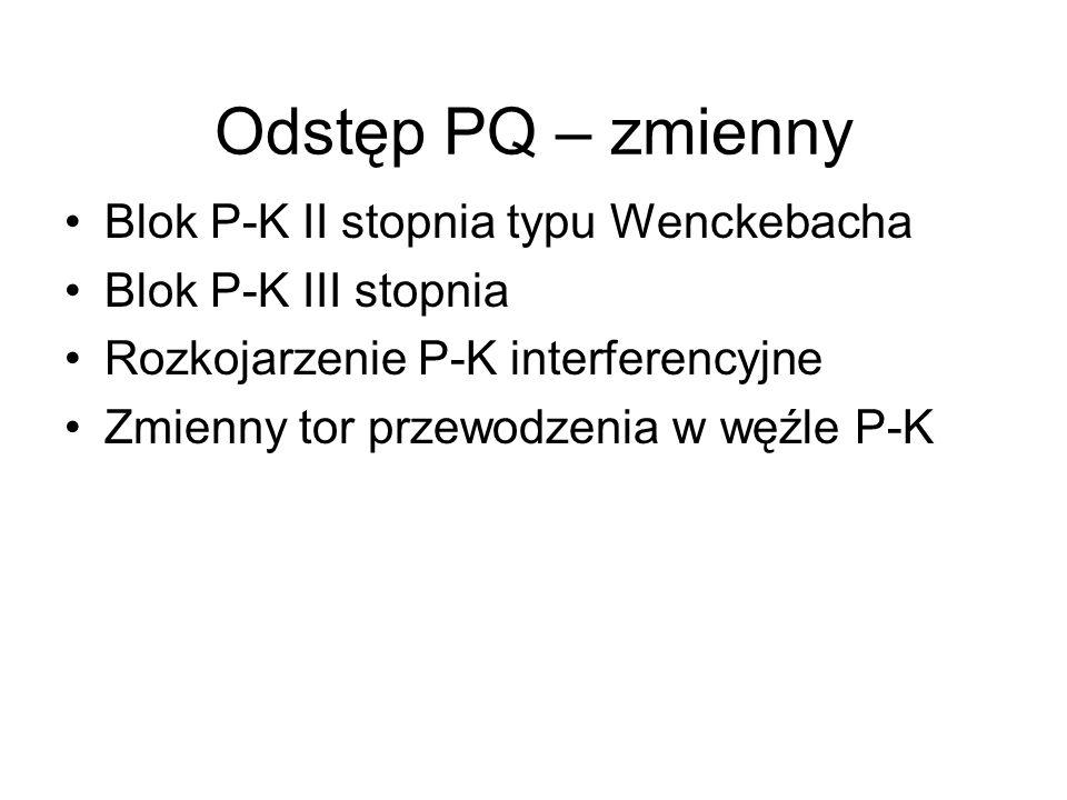 Odstęp PQ – zmienny Blok P-K II stopnia typu Wenckebacha
