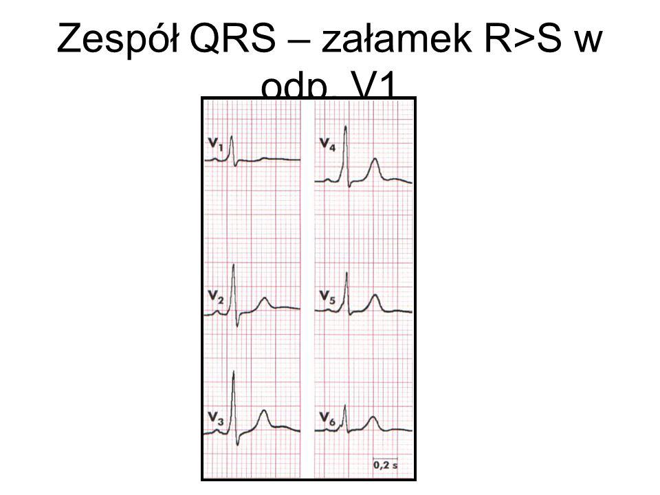 Zespół QRS – załamek R>S w odp. V1