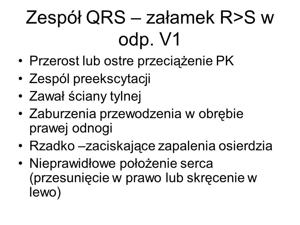 Zespół QRS – załamek R>S w odp. V1