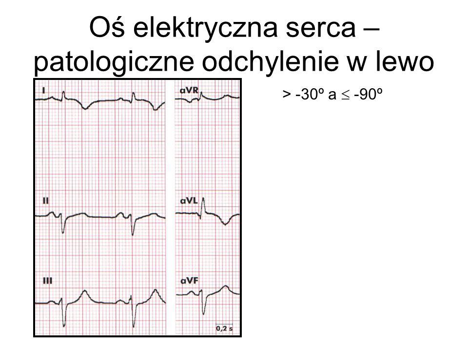Oś elektryczna serca – patologiczne odchylenie w lewo