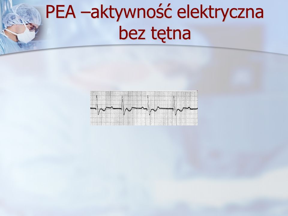 PEA –aktywność elektryczna bez tętna
