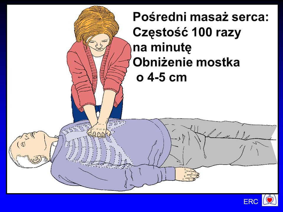 Pośredni masaż serca: Częstość 100 razy na minutę Obniżenie mostka o 4-5 cm