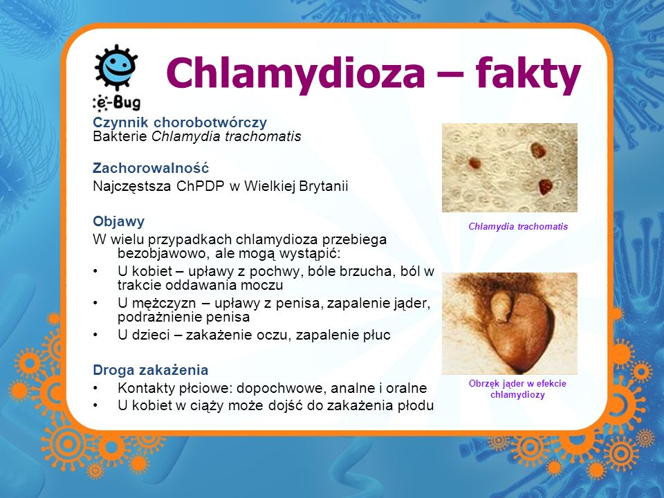 Chlamydia trachomatis Obrzęk jąder w efekcie chlamydiozy