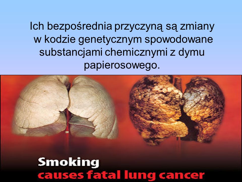 Ich bezpośrednia przyczyną są zmiany w kodzie genetycznym spowodowane substancjami chemicznymi z dymu papierosowego.