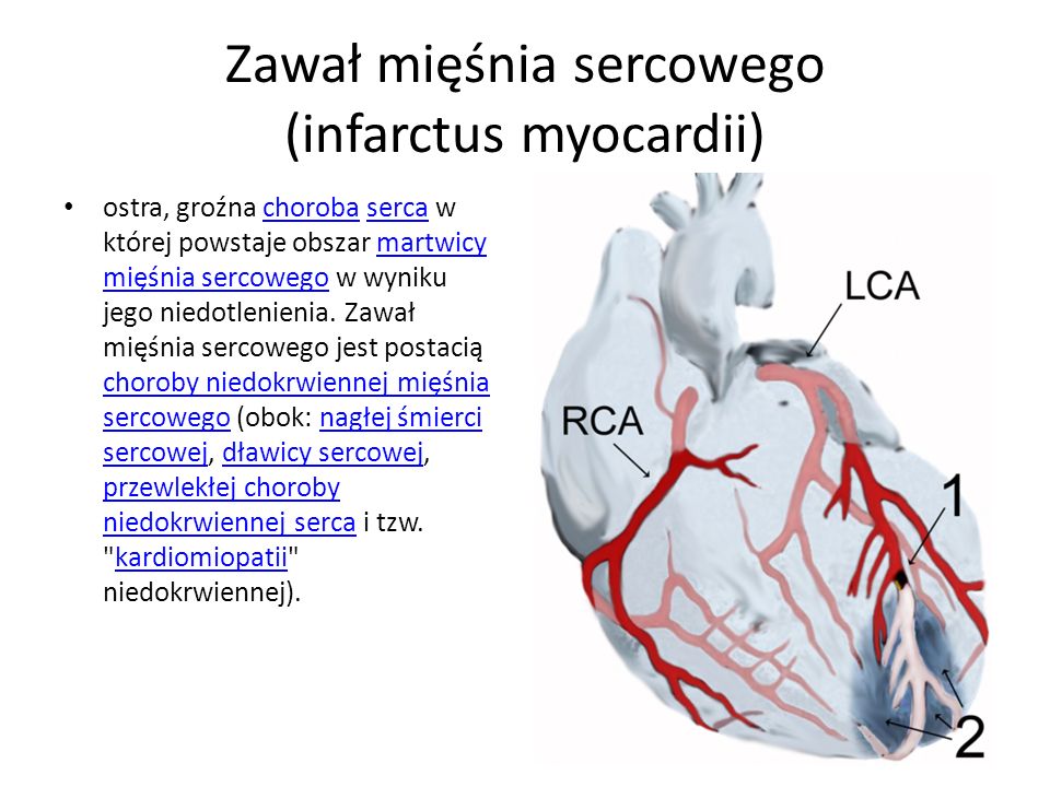 Zawał mięśnia sercowego (infarctus myocardii)