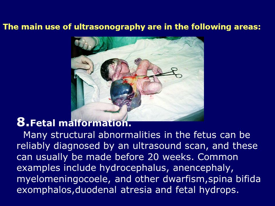 The main use of ultrasonography are in the following areas: