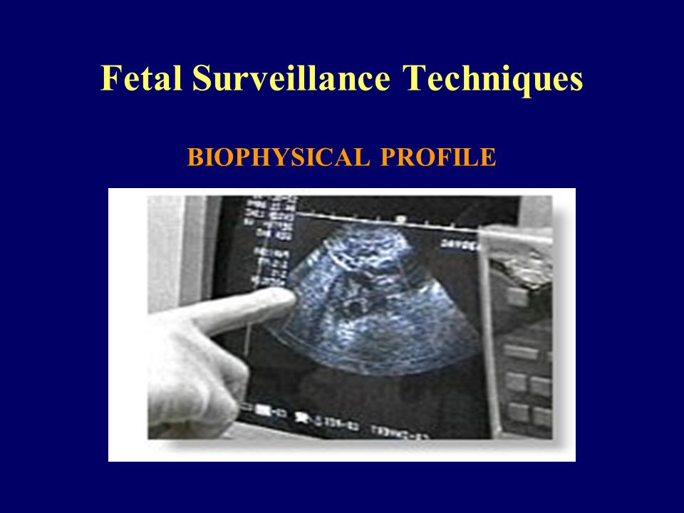 Fetal Surveillance Techniques BIOPHYSICAL PROFILE