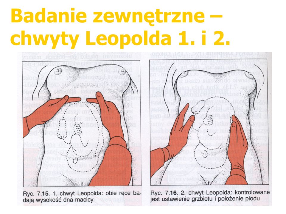 Badanie zewnętrzne – chwyty Leopolda 1. i 2.