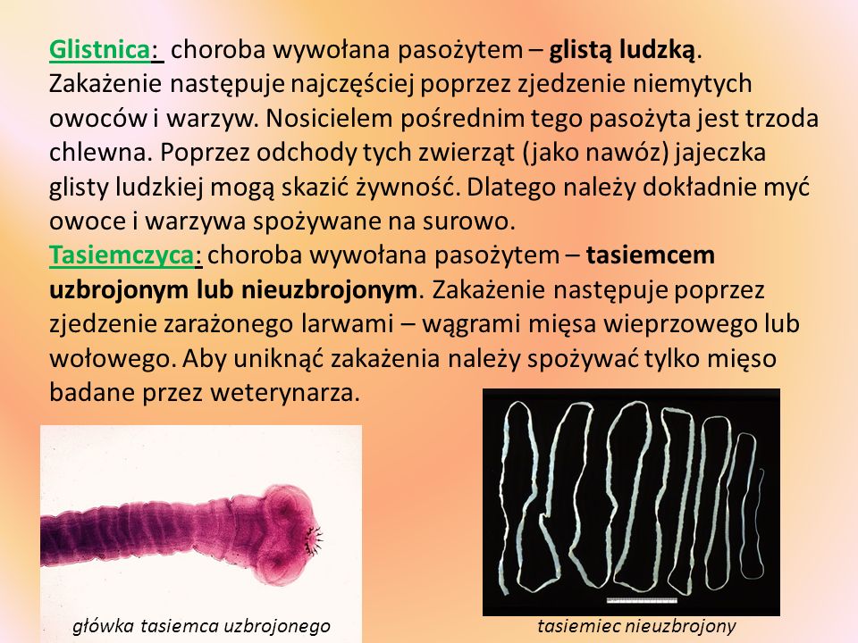 Glistnica: choroba wywołana pasożytem – glistą ludzką