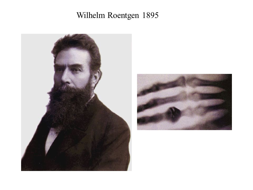 Wilhelm Roentgen 1895