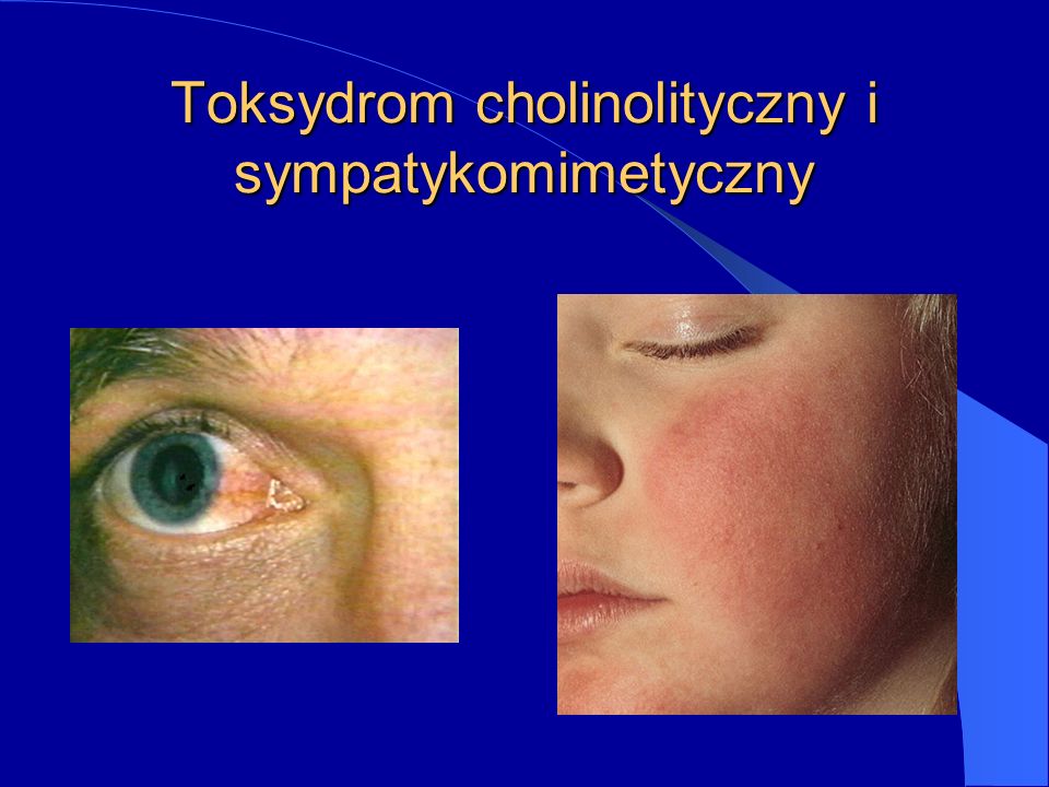 Toksydrom cholinolityczny i sympatykomimetyczny