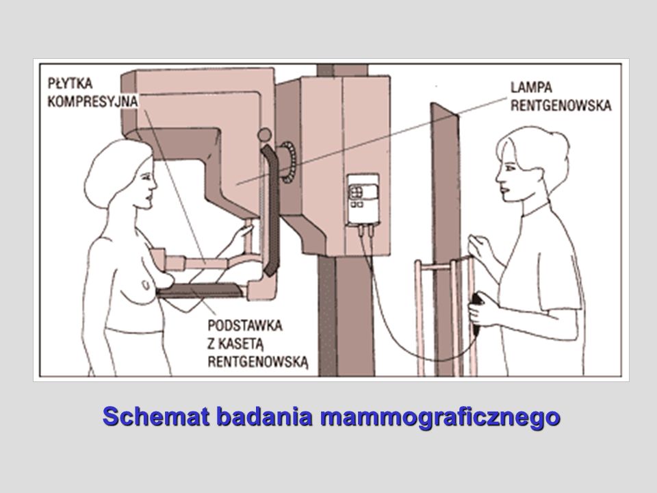 Schemat badania mammograficznego