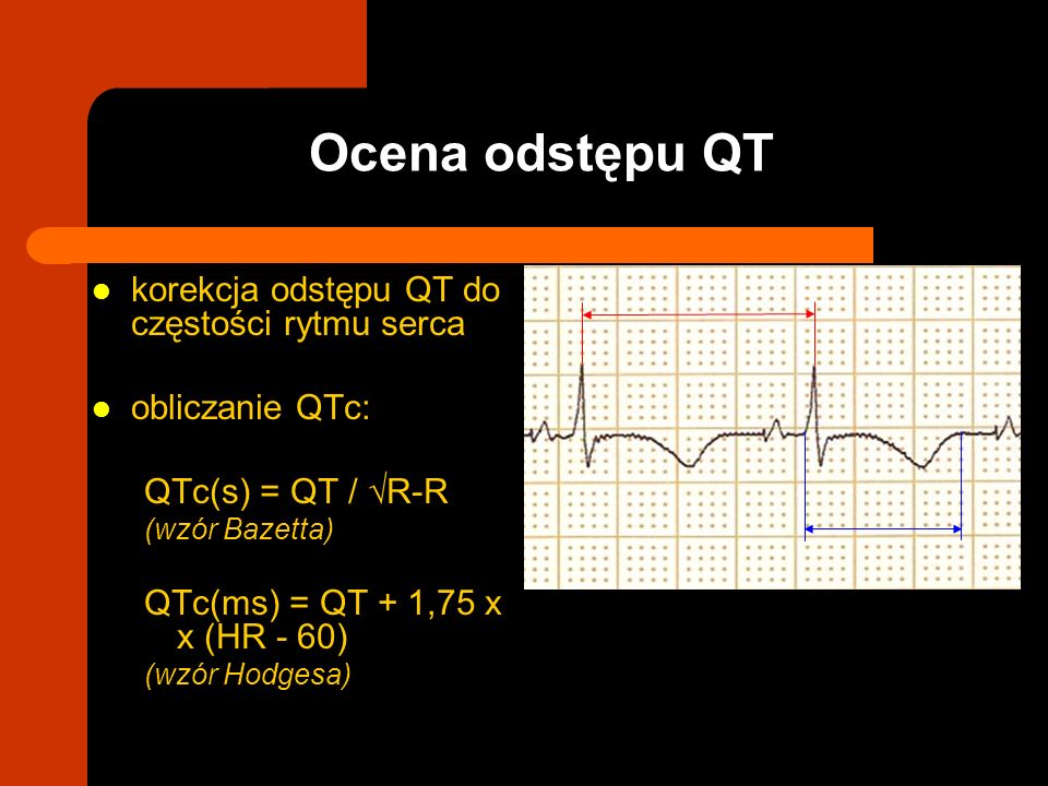 Ocena odstępu QT korekcja odstępu QT do częstości rytmu serca