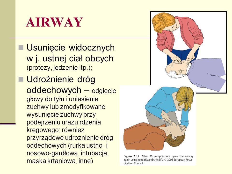 AIRWAY Usunięcie widocznych w j. ustnej ciał obcych (protezy, jedzenie itp.);