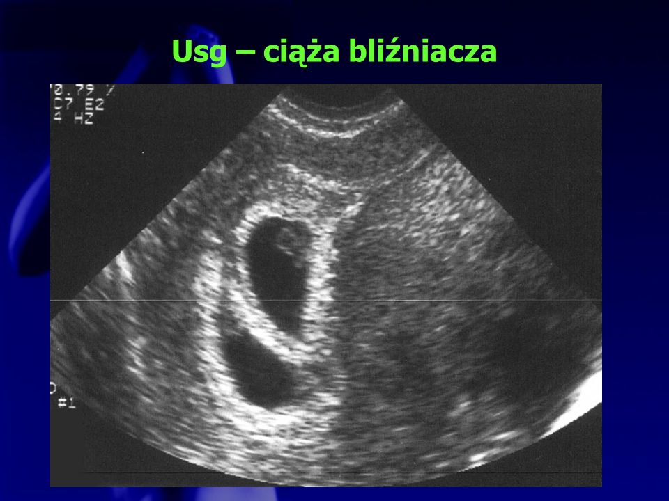 Wczesna ultrasonografia ciążowa