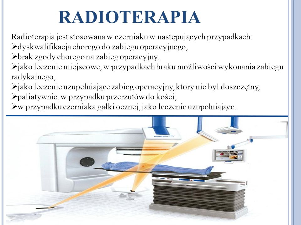 radioterapia Radioterapia jest stosowana w czerniaku w następujących przypadkach: dyskwalifikacja chorego do zabiegu operacyjnego,