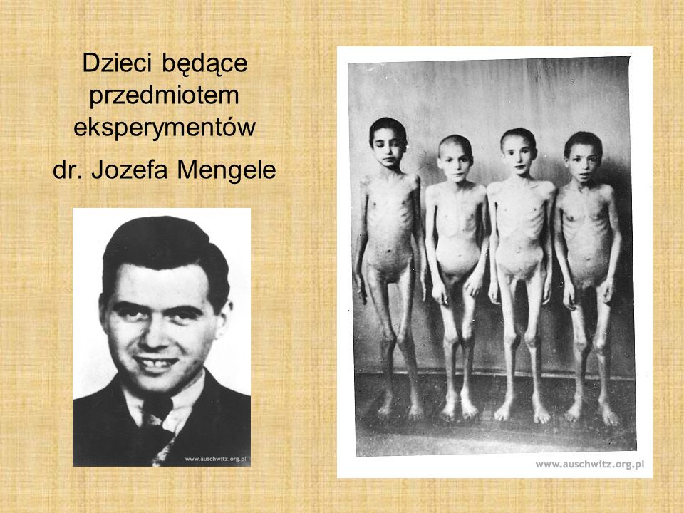 Dzieci będące przedmiotem eksperymentów dr. Jozefa Mengele