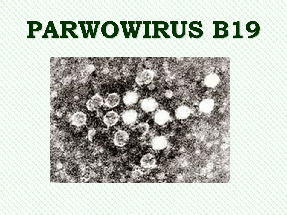 PARWOWIRUS B19