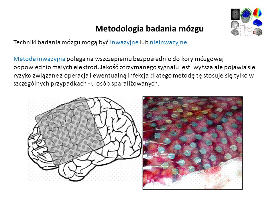 Metodologia badania mózgu