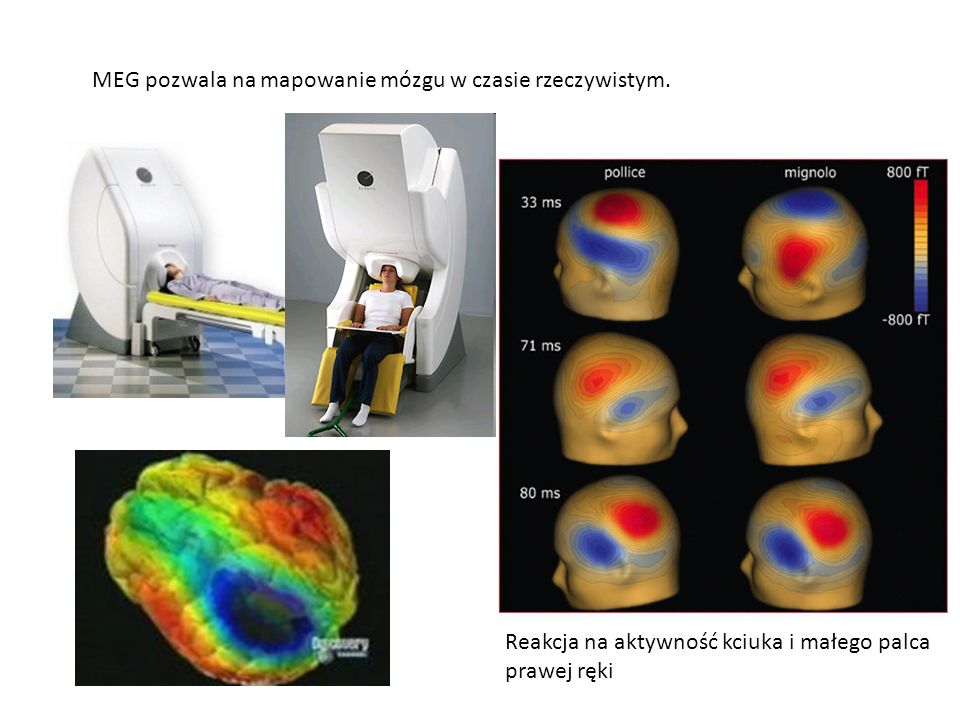 MEG pozwala na mapowanie mózgu w czasie rzeczywistym.