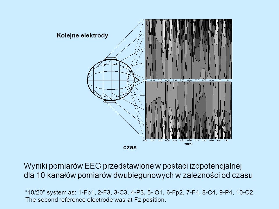 Wyniki pomiarów EEG przedstawione w postaci izopotencjalnej