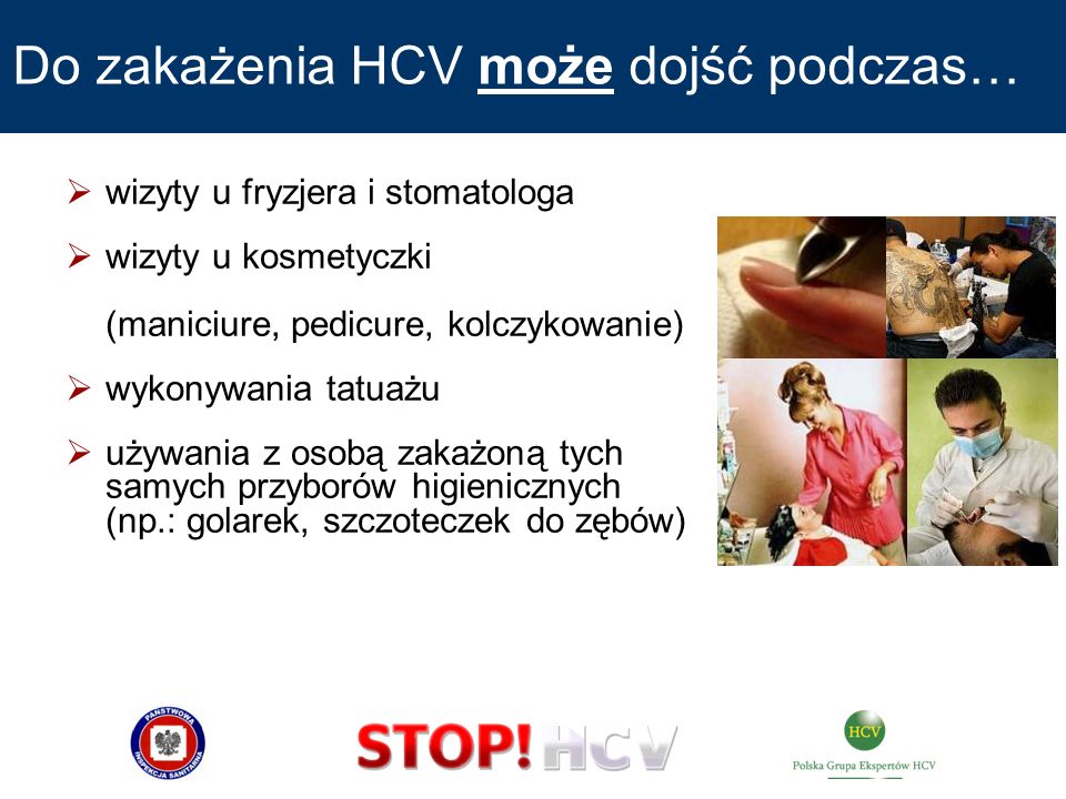Do zakażenia HCV może dojść podczas…