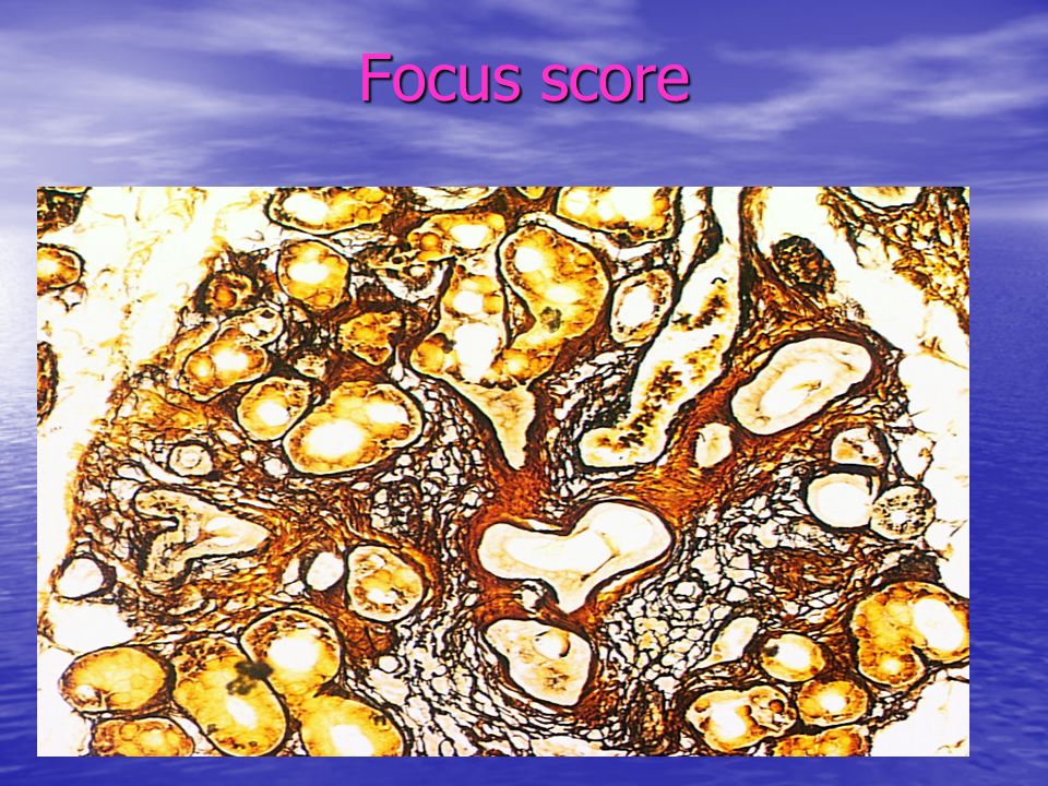 Focus score