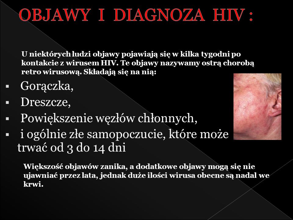 OBJAWY I DIAGNOZA HIV : Gorączka, Dreszcze,