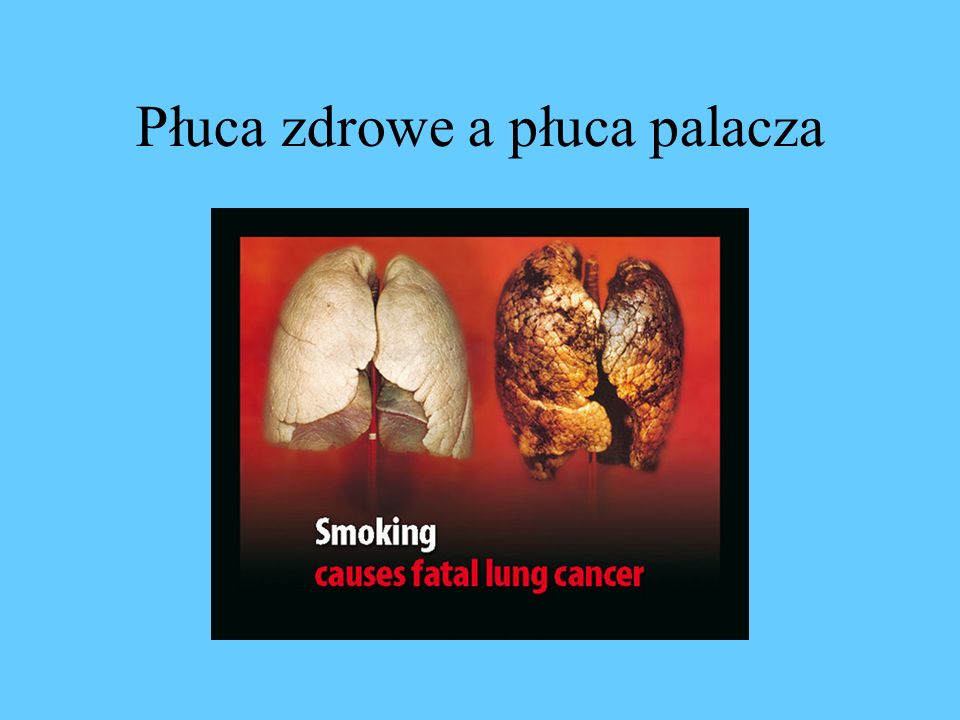 Płuca zdrowe a płuca palacza