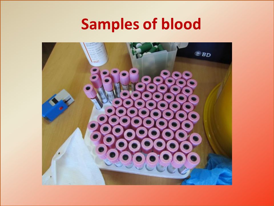 Samples of blood