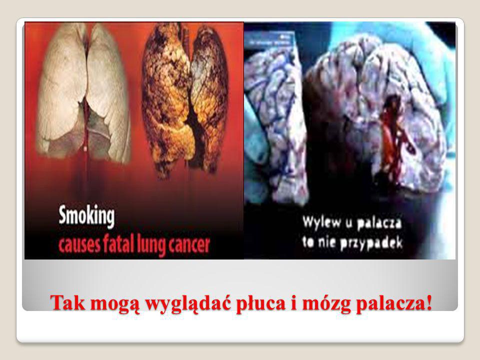 Tak mogą wyglądać płuca i mózg palacza!